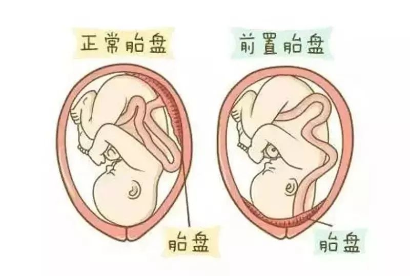 17, 国王福克斯韧带撕裂  